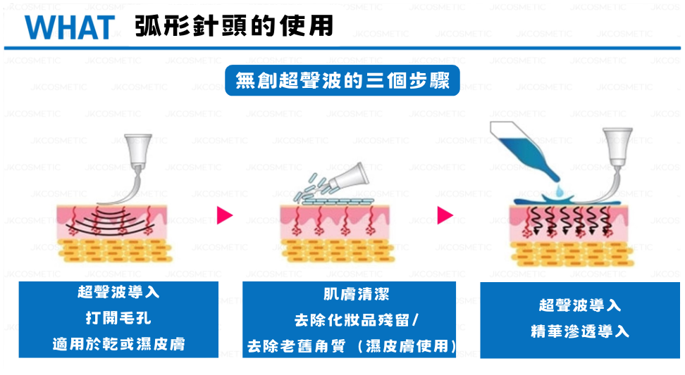 韓國🇰🇷 Arcsonic無創超聲波清黑頭機 4頭