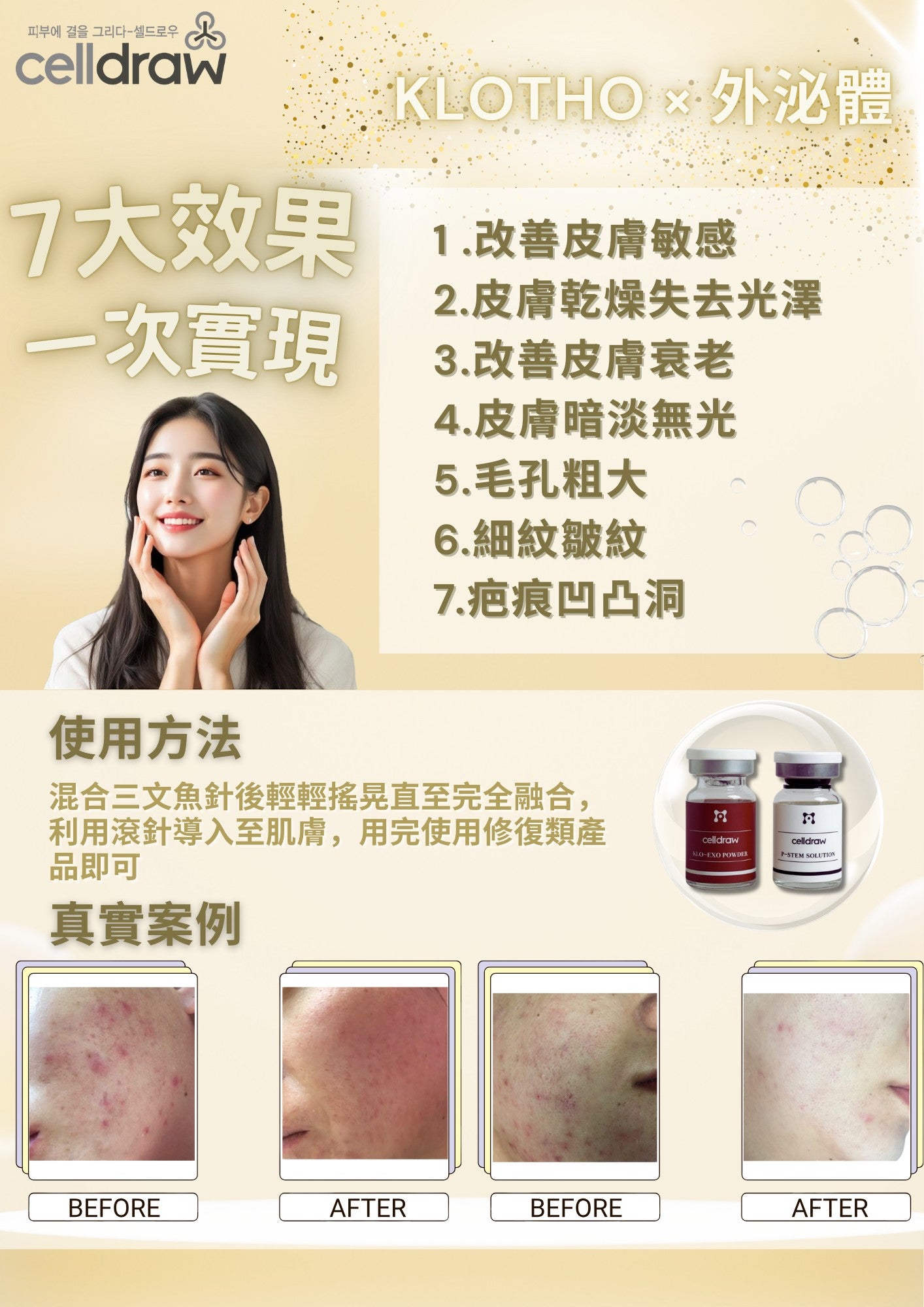 【買2送1】韓國 Celldraw KLO-EXO Solution 外泌體抗衰再生套組 20mg1瓶 + 三文魚針1支（KP Set）