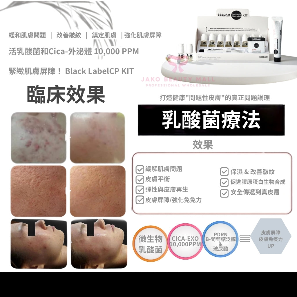 【現貨】韓國Ssedam 乳酸菌積雪草外泌體套盒| 外泌體去痘修復+重建皮膚免疫力