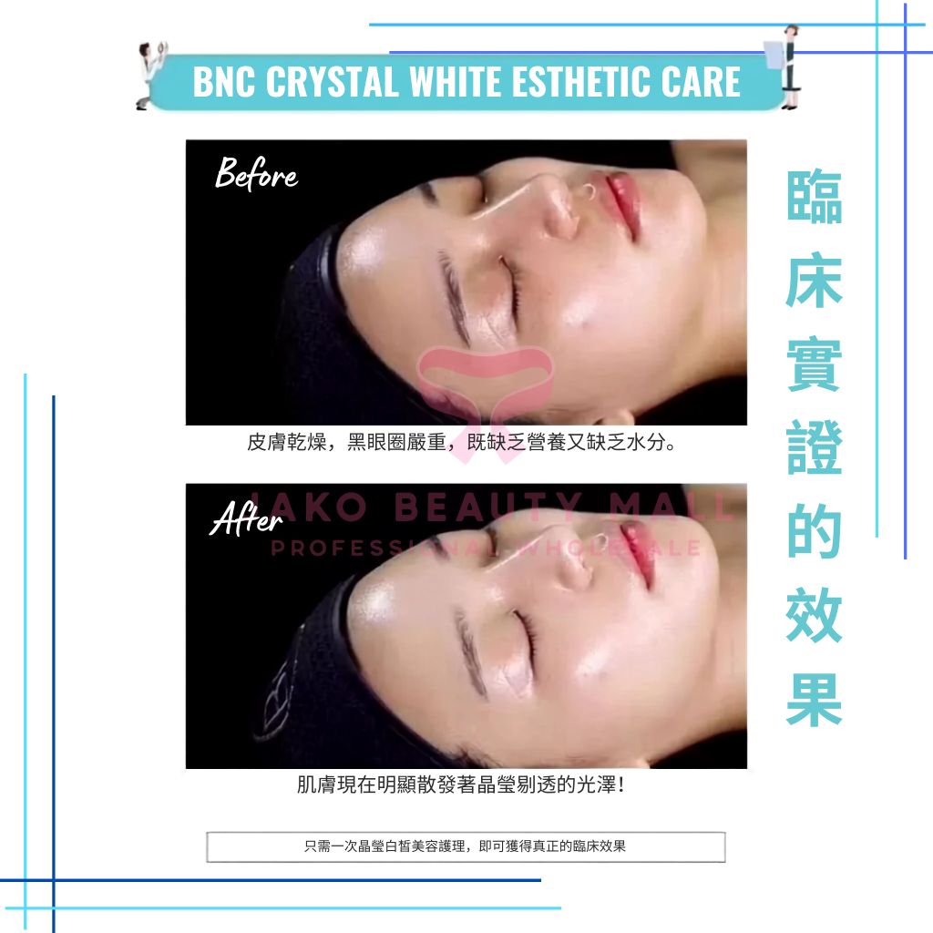 Korea BNC Crytral white Song Hye-kyo Whitening & Rejuvenating Treatment (30 sessions)