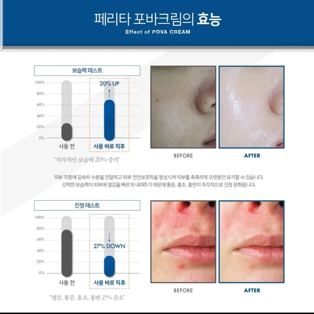 韓國CELLDICH Tox Co2 KIT注氧再生套盒  6次/盒