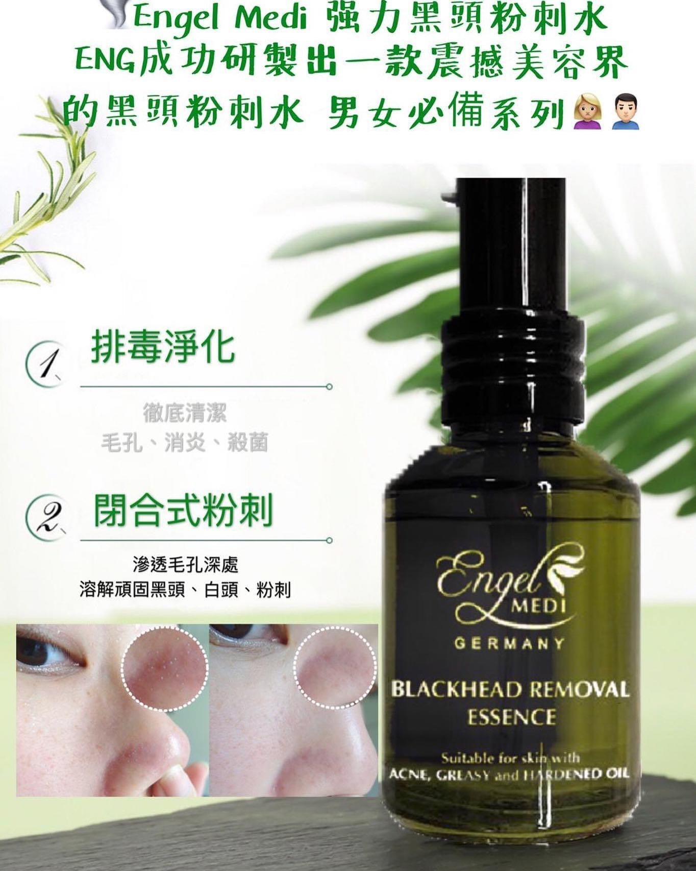 德國Engel Medi 强力黑頭粉刺水 30ml