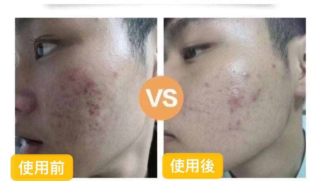 【臨期特價】韓國Dr lab ph 平衡退紅霜Red Spot Care Cream 60ml